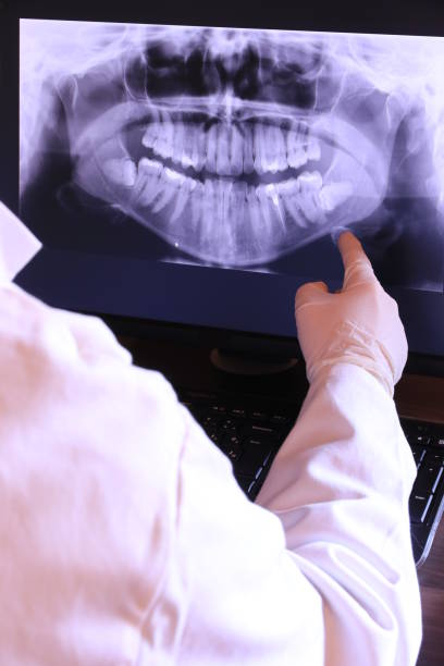 Best Chipped Tooth Repair Near Me  in Springville, NY